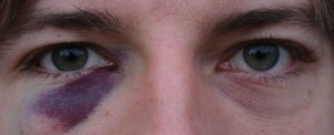 vedec_eye2